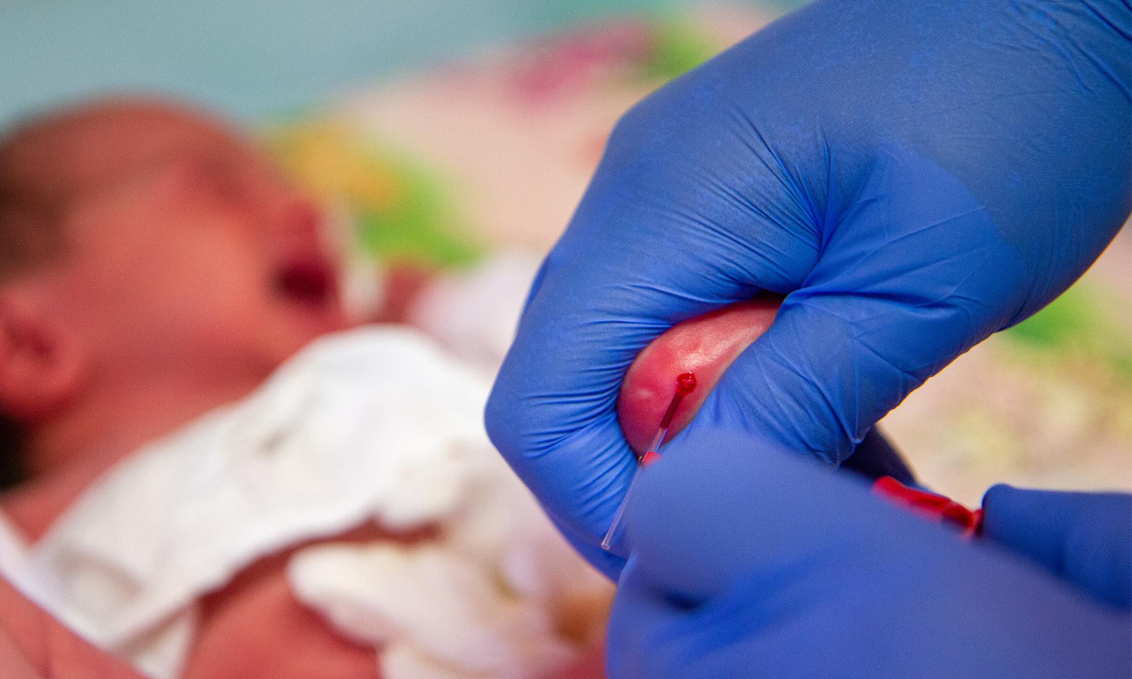 An image of a traditional baby heel prick